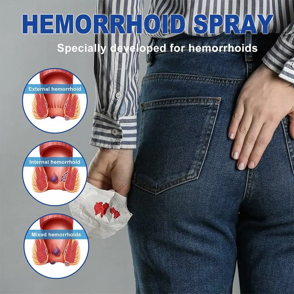 Hemorrhoids Relief Cream Powerful Soothing Ointment For Internal Hemorrhoids Piles External Anal Fissure Care Anus Sore Relief