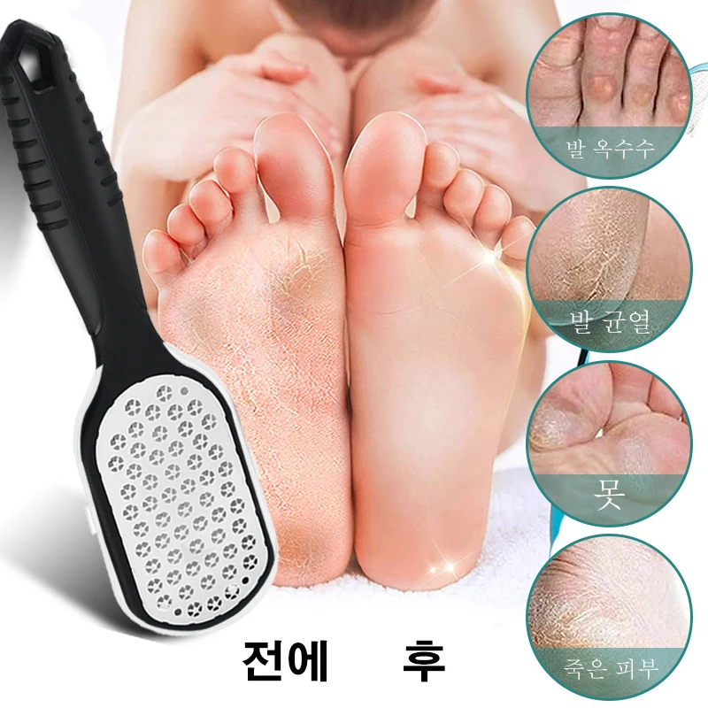 1 Pcs 전문 스테인레스 스틸 캘러스 리무버 발 파일 스크레이퍼 페디큐어 도구 죽은 피부 발 뒤꿈치 피트 케어 제품 제거