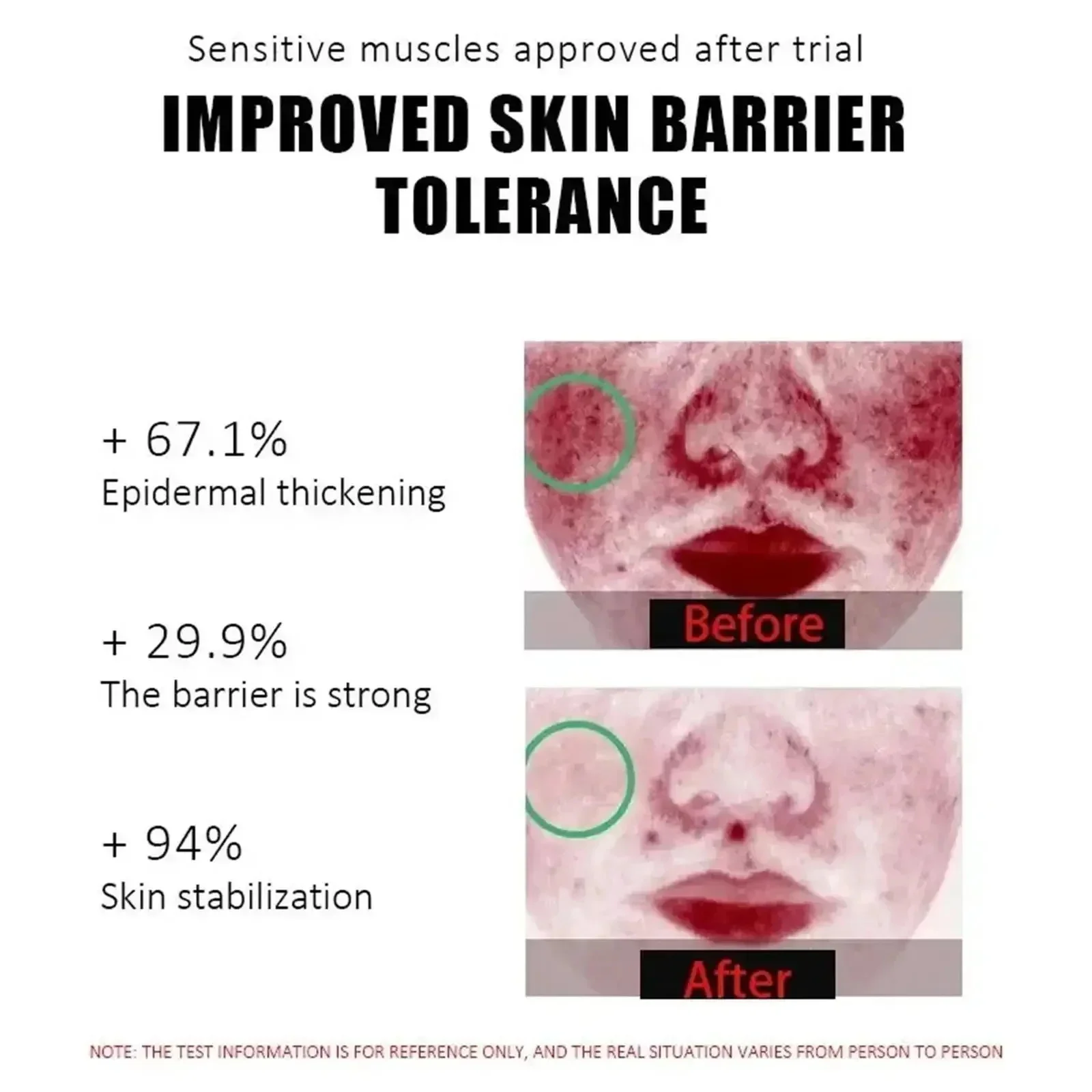 Facial Redness Relief Moisturizing Cream