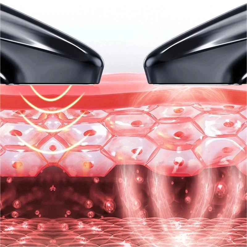 Acne Removing Instrument Meter Plasma Pen Lifting Treatment Beauty Instrument Ozone Treatment Facial Acne Therapy Firming Skin