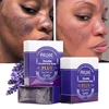 AILKE Reduce Blemish Smooth Skin Soap, Scented Bar, For Black Skin, Dark Skin, Caramel Skin, Lightening for Face & Body 5