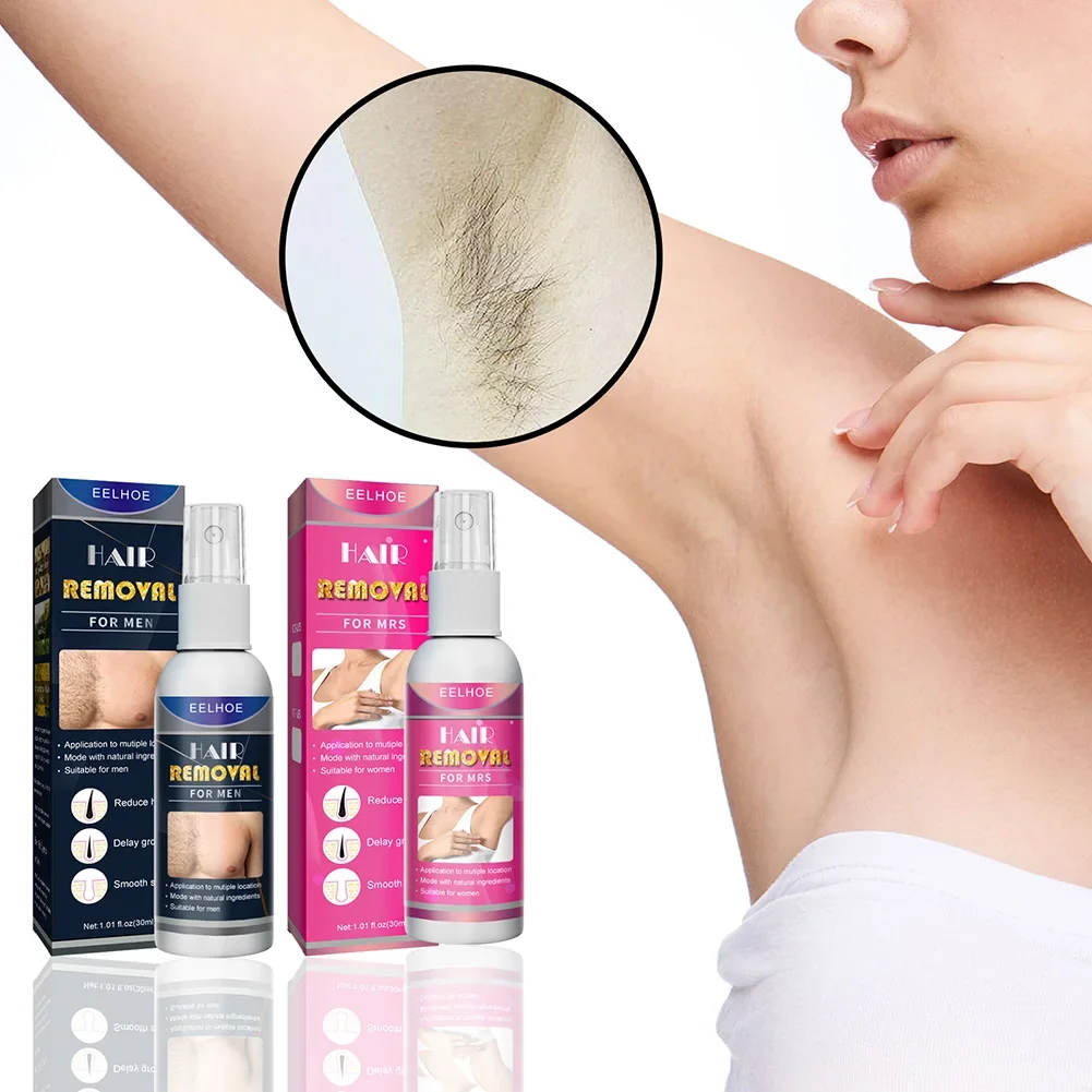 

Sdotter 30/50ml Powerful Hair Removal Spray Super Natural Painless Permanent Hair Remover for Women Men Whole Body Depilatory Cr