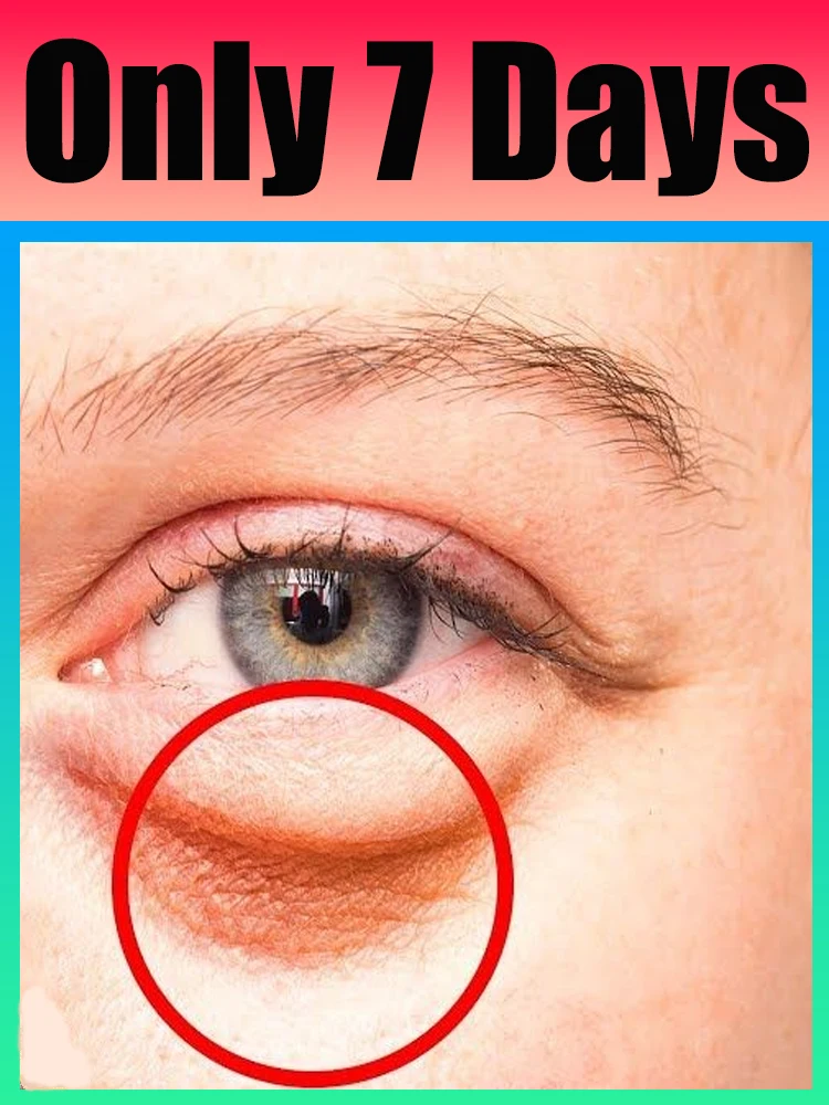 눈 관리 도구, 2025년 인기 판매 눈가 케어 제품, 더 많은 병을 구매할수록 더..