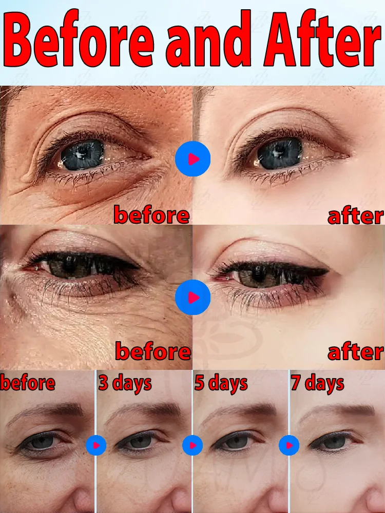 Eye cream anti wrinkle brightens and removes dark circles