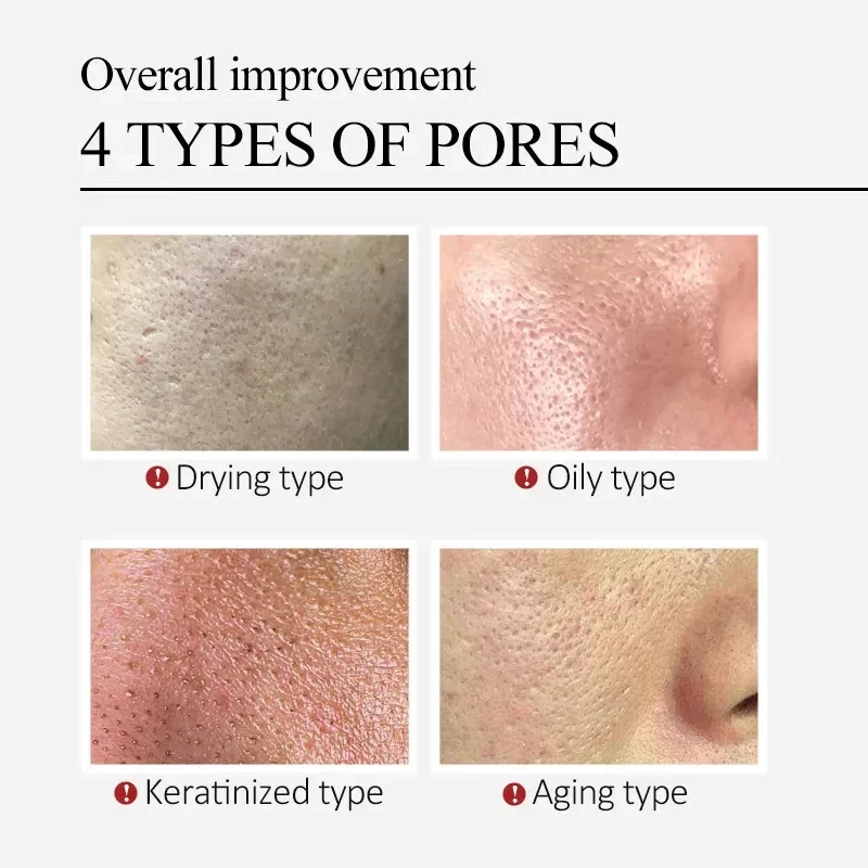 Description Picture 5 of itemSalicylic Acid Pore Shrinking Cream Quick Remove Blackehead Elimination Large Pores Tighten Face Smooth Skin Korean Care Product