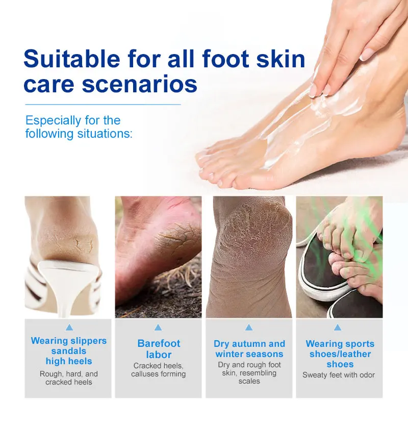 Description Picture 6 of itemUrea Foot Cream Moisturizing Exfoliating Hand Feet Dead Skin Removal Anti Peeling Heels Repair Mask Foot Skin Care Products