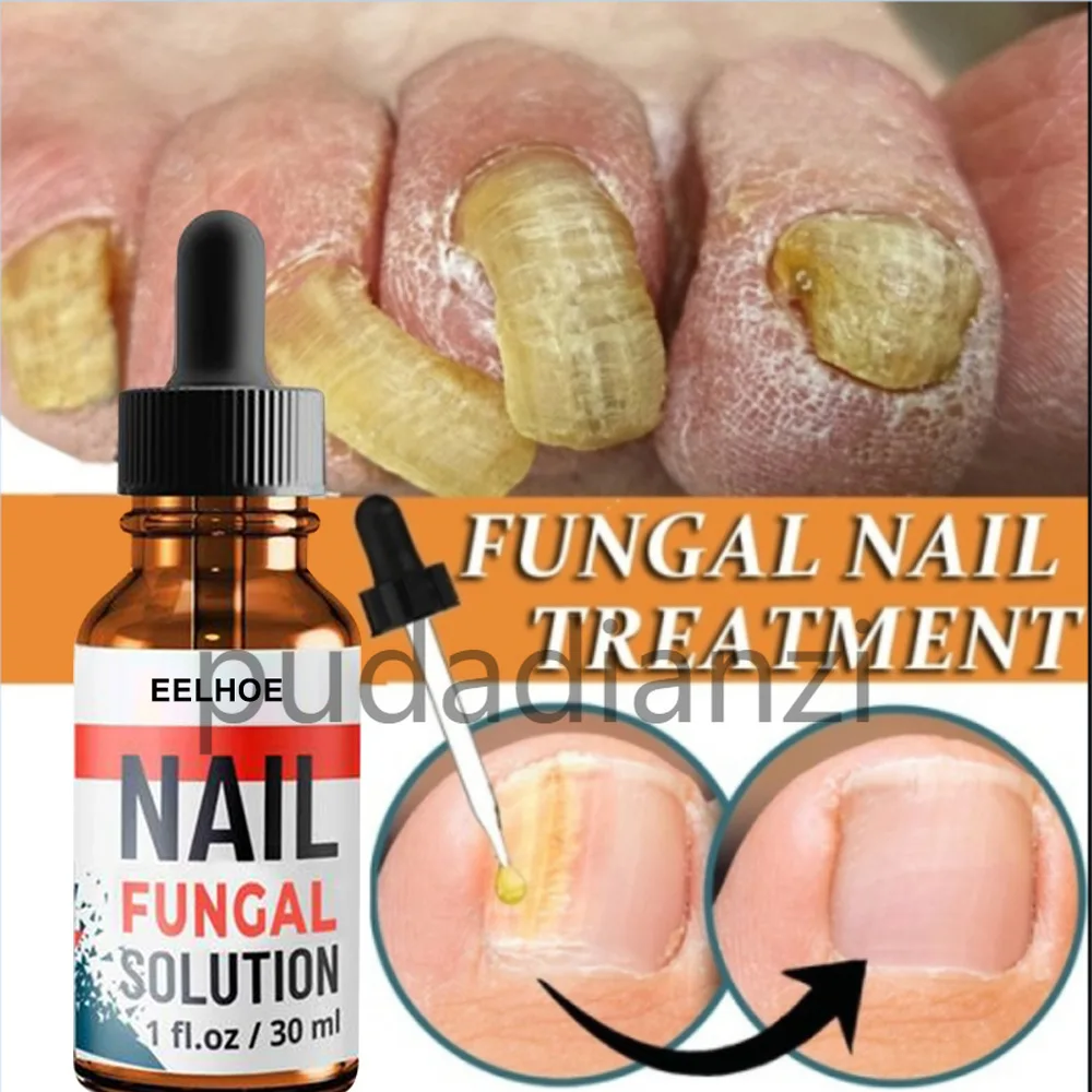 Nail Repair Liquid Hand And Foot Grey Nail Care Repair Grey Nail Liquid