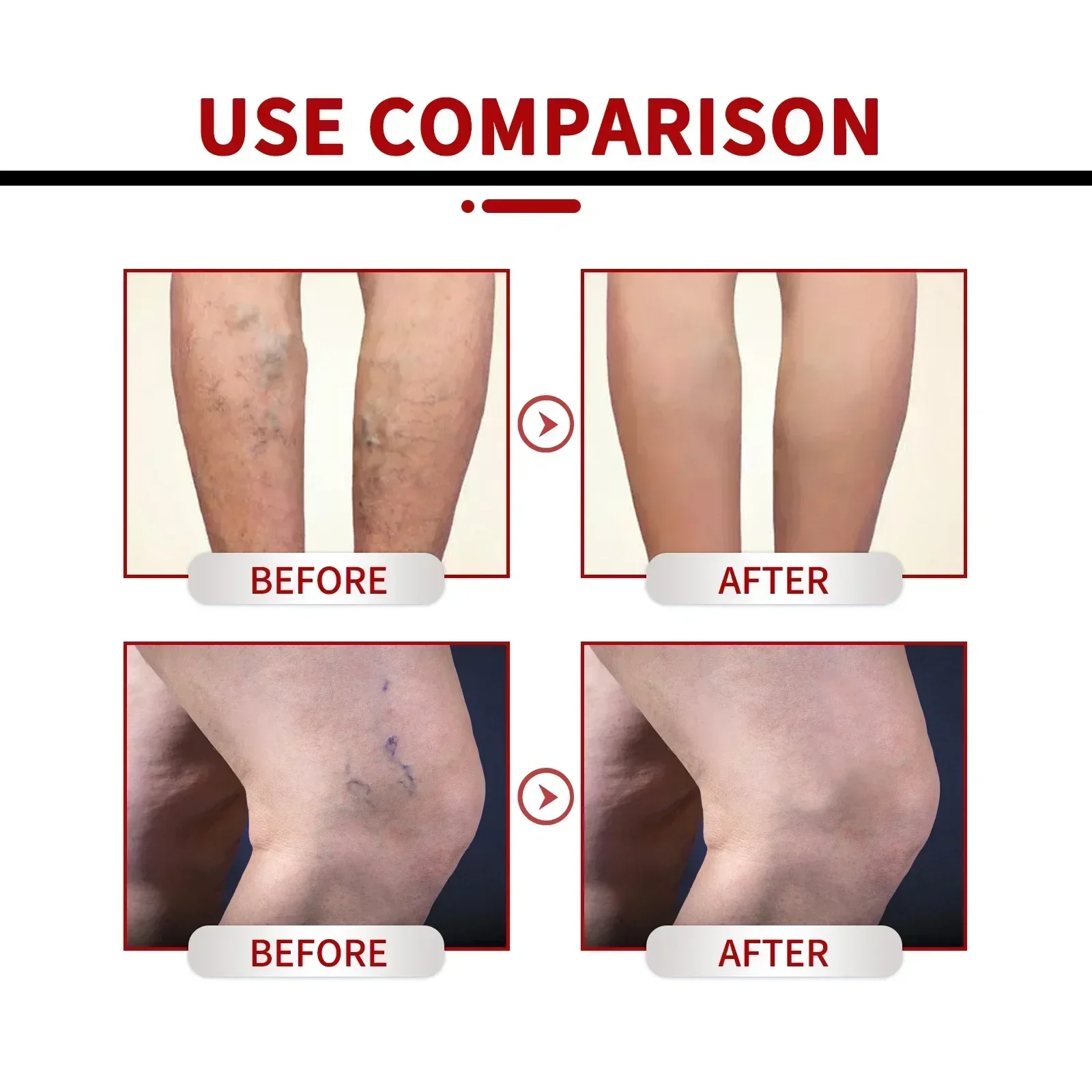 Leg Skin Care Cream