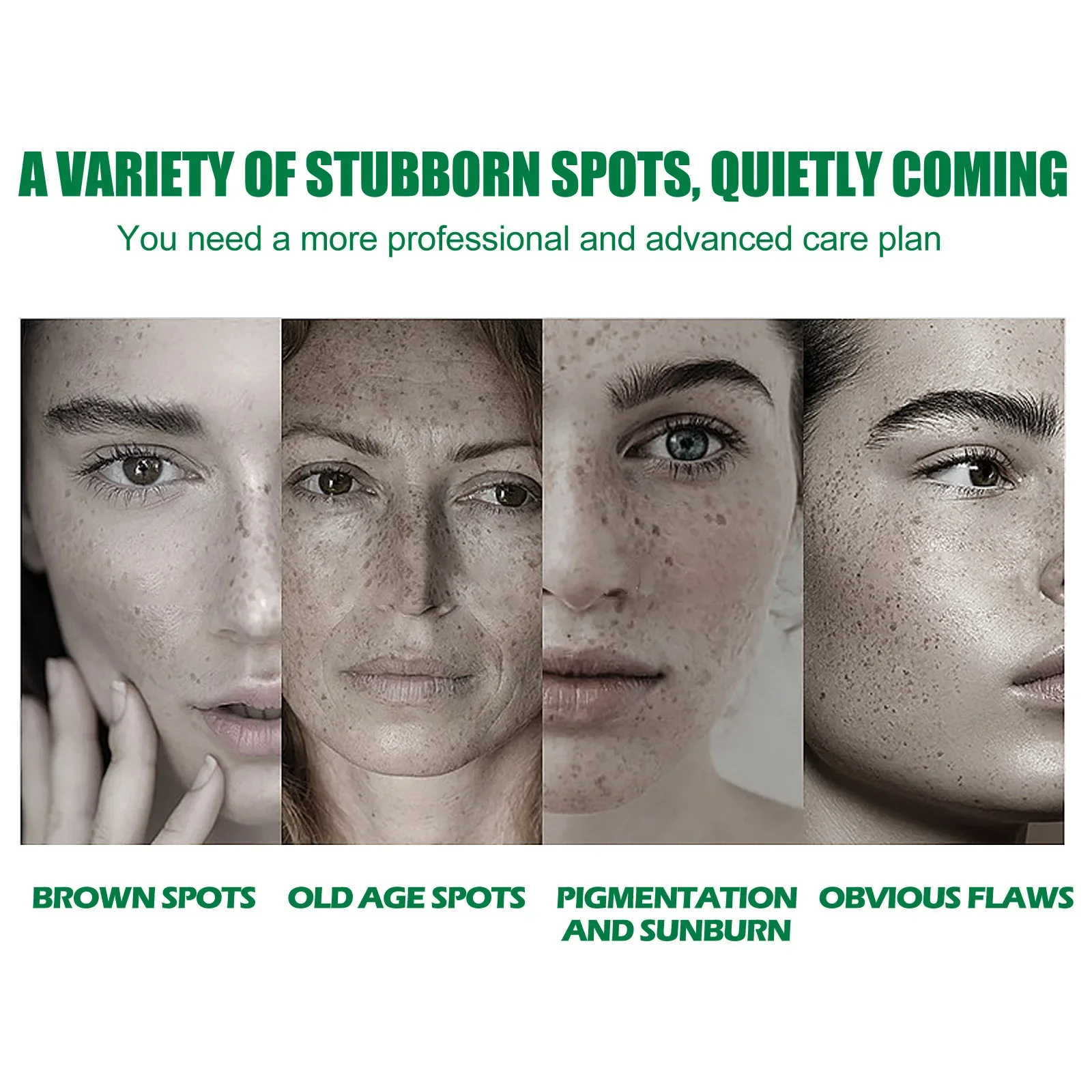 Whitening Freckle Serum Fade Pigmentation Moisturizing Brightening Improve Dull Anti Aging Remove Dark Spots Face Care Essence 3