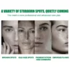 Whitening Freckle Serum Fade Pigmentation Moisturizing Brightening Improve Dull Anti Aging Remove Dark Spots Face Care Essence 3