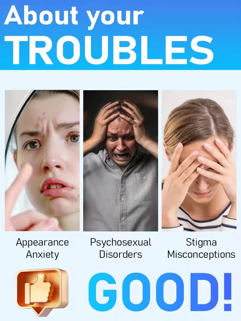 Wart Care Blue Light Pen 2