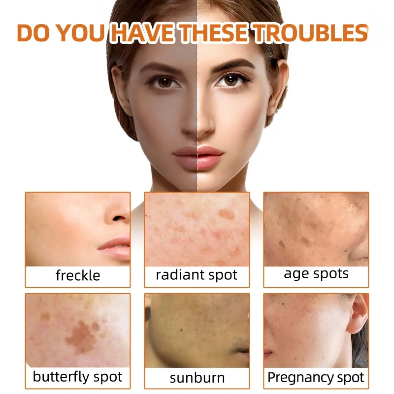 Turmeric Facial Soap Repair Dull Fade Dark Spots reduce Fine Lines Freckle brighten Skin firming whitening face Cleansing Soap 4