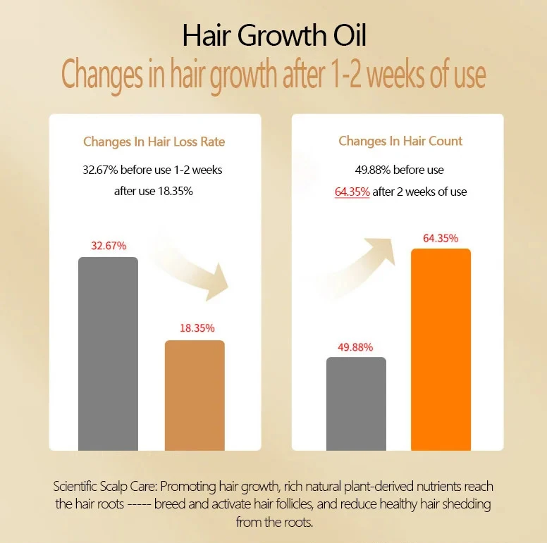 Description Picture 3 of itemHair Growth Spray Anti Hair Loss Essence Hair Regrowth Serum Treatment Alopecia Prevent Baldness Nourish Scalp 30ml