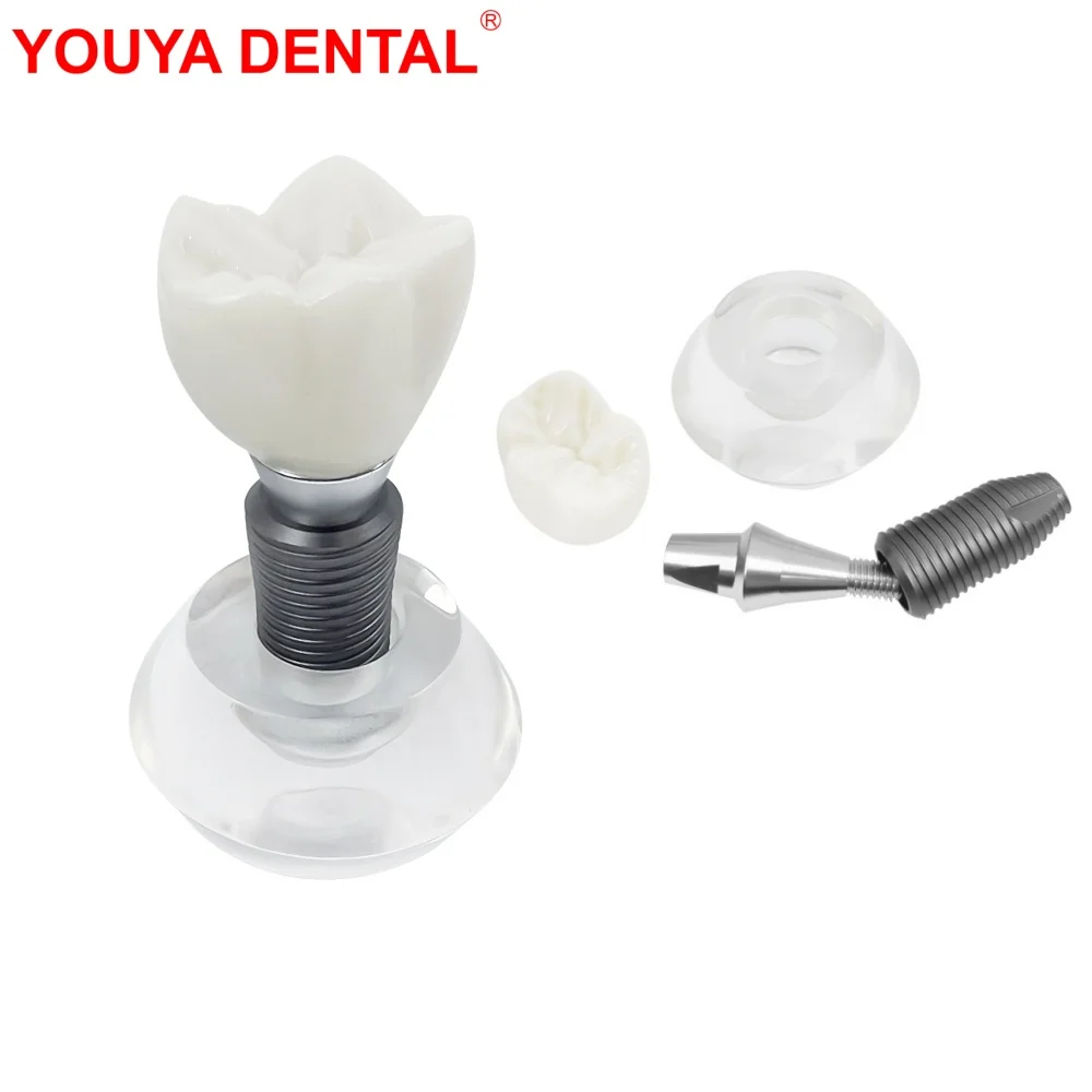 

Clear Implant Denture Model Crystal Dental Implant Teeth Model Crown Typodont Structure For Teaching Studying Practice Training