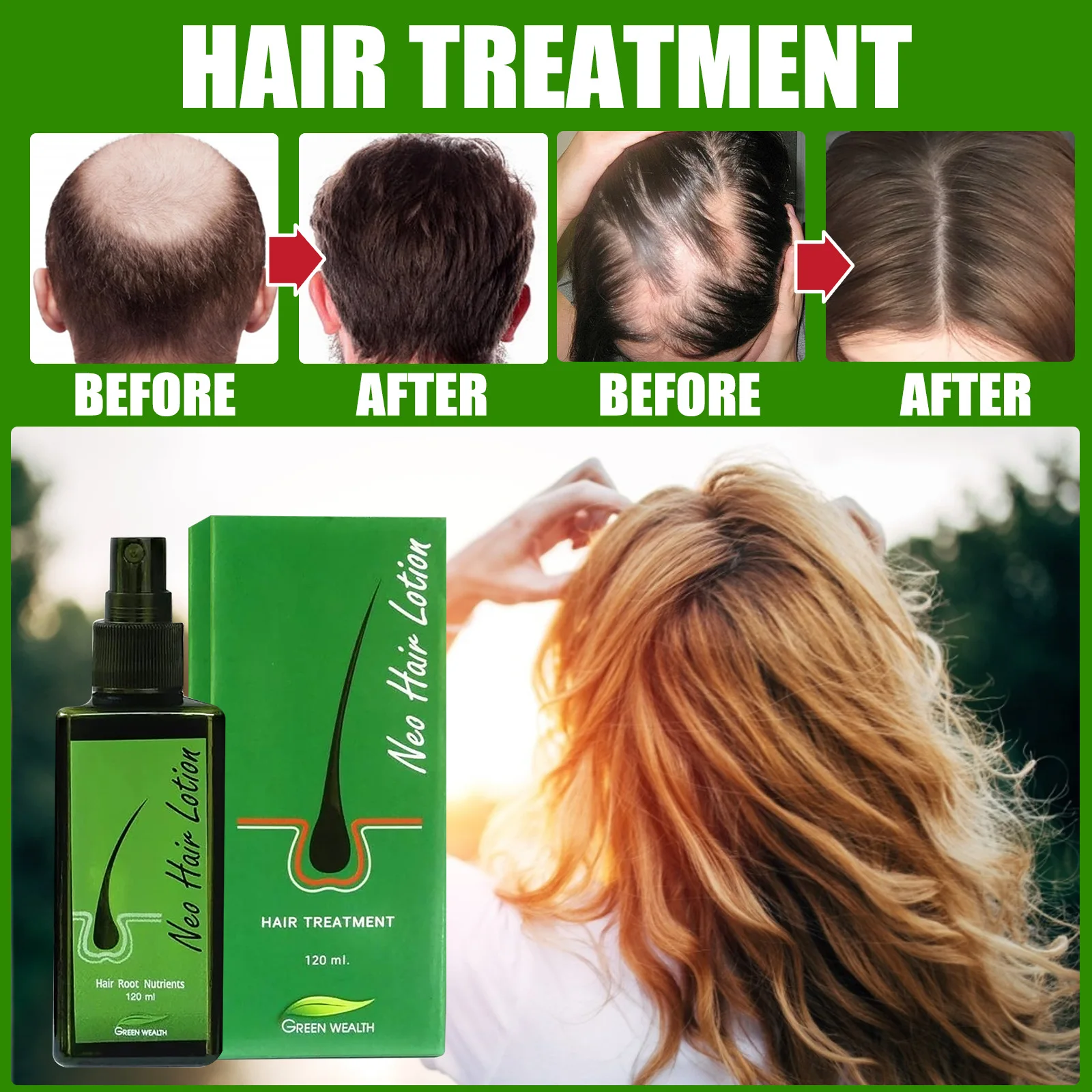 120mlHairGrowthSprayPreventHairLossScalpTreatmentsThickenHair