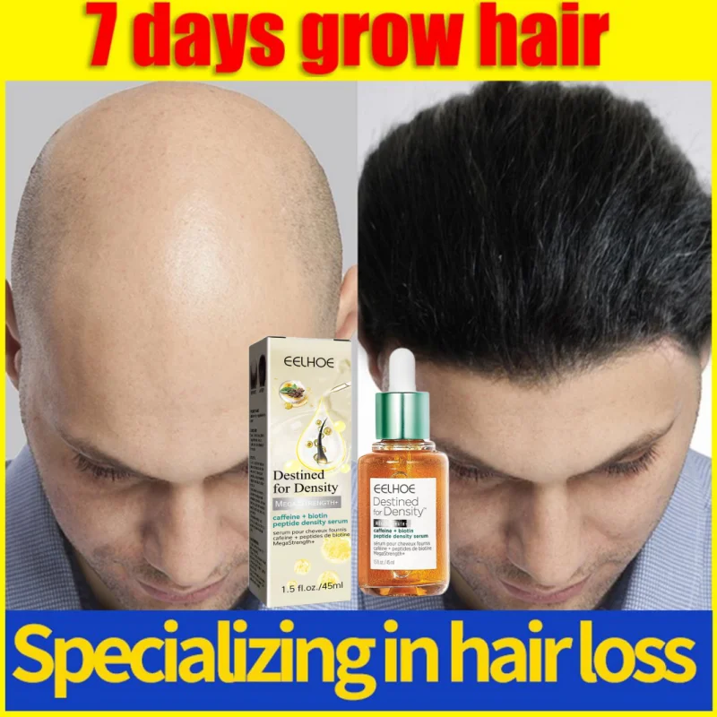 

1/3/5/10 PCS Fast Hair Growth Hair Follicle Treatment Hair Growth Upward Postpartum Hair Loss Baldness Seborrheic Alopecia Hairl