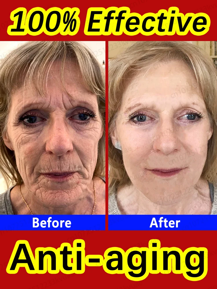 

Эффективная Сыворотка для лица против старения и морщин, для удаления морщин и тонких линий вокруг глаз, вороны, ног, шеи, складок