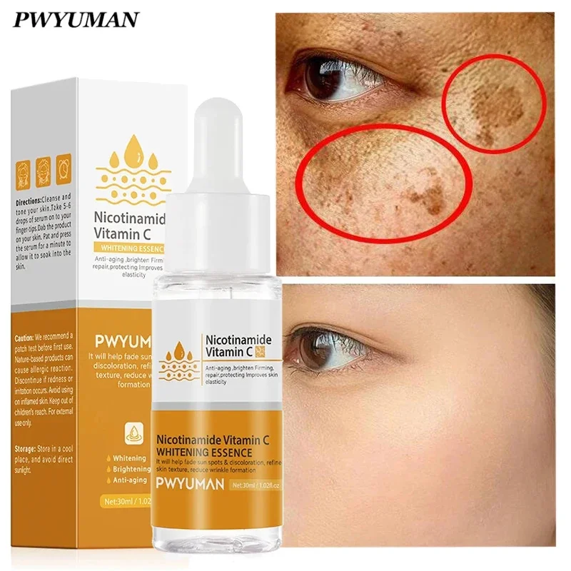 

Vitamin C Whitening Freckles Serum for Face Dark Spots Remover Products Nicotinamide Melasma Melanin Brighten skincare Cosmetics