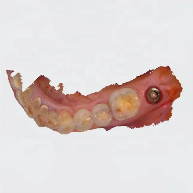 2022 CE утвержденный цифровой сканер