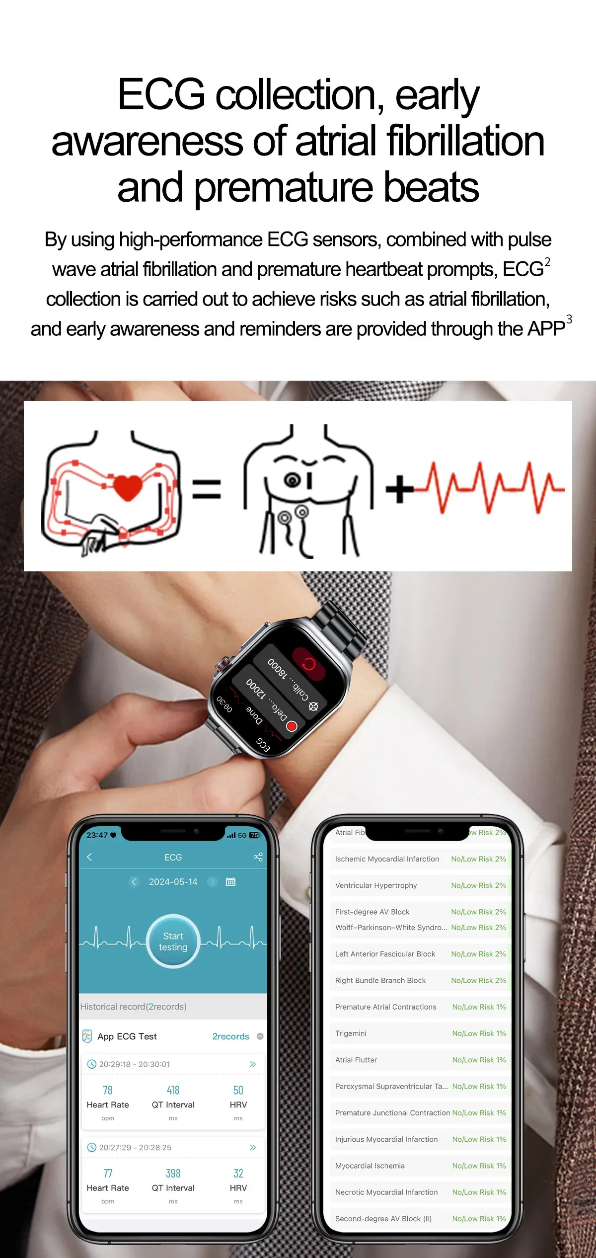 Smart Watch ET585 Men AMOLED ECG Blood Compositoin Health Monitoring Bluetooth Call Women Sports Fitness Tracker Smartwatch