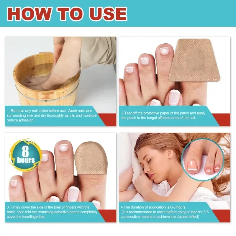 Nail Treatment Patch Anti Fungal Nail Correction Stickers Ingrown Toenail Care Paronychia Anti Infection Repair Patch