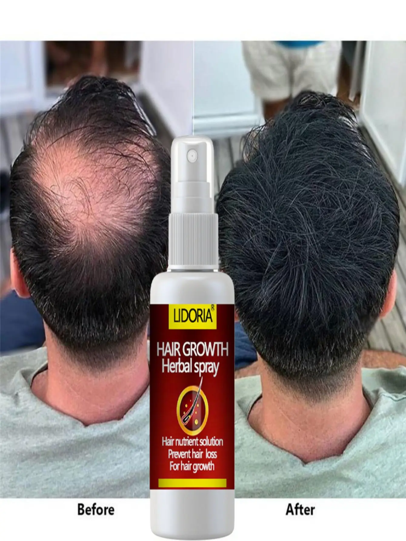 Serum na porost włosów w sprayu Szybki porost włosów Płynna leczenie Skóra głowy Płyn włosowy Przeciw wypadaniu włosów Naturalne piękno Zdrowie Pielęgnacja włosów - AliExpress 66