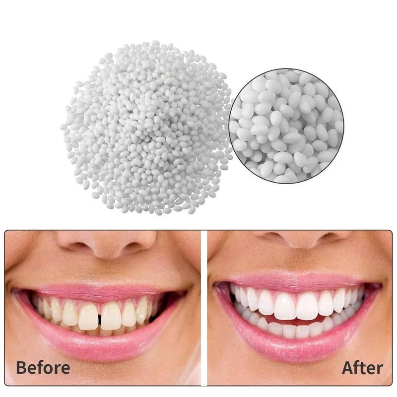 50g Tooth Repair Kit Dental Care Glue for Filling Missing Broken Crowns