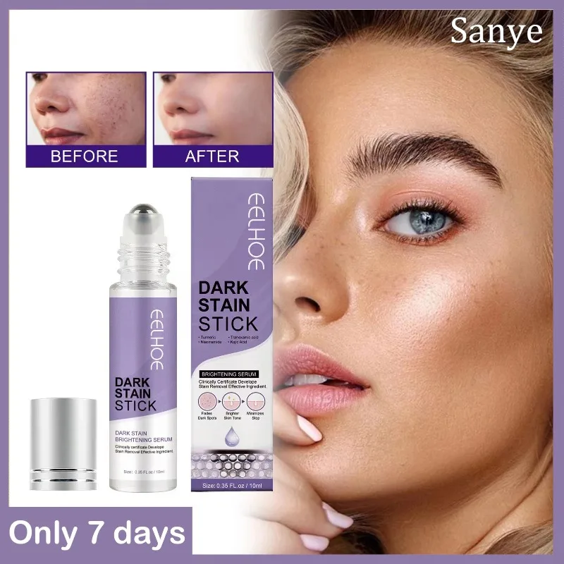 

Women Freckles Repair Essence Fade Dark Spots Whitening Serum Melasma Melanin Remover Facial Brightening Serum Korean Skin Care