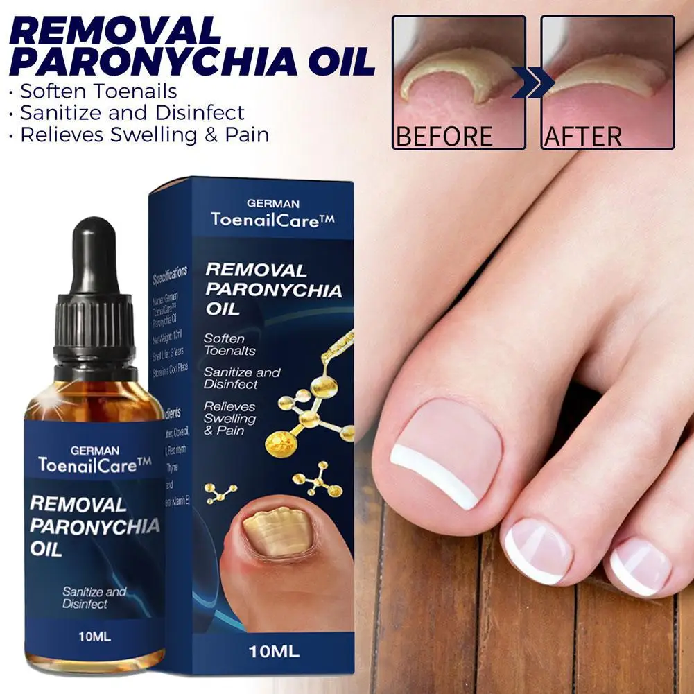 Endogenous Nail Repair Care Essential Oil Essence Clean and Remove Toenail Treatment Feet Care Removal Paronychia Oil