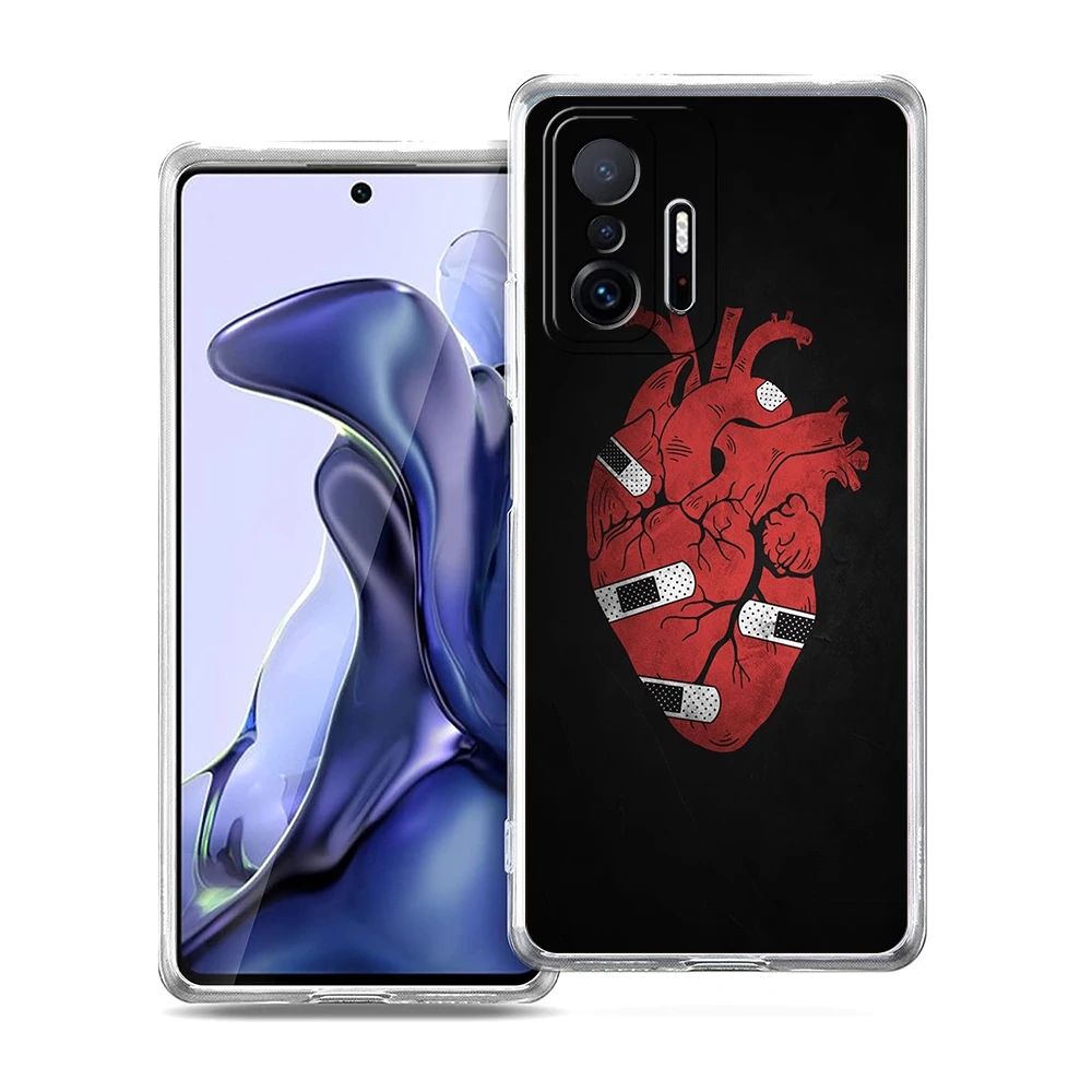CartoonArt Transparent Soft Phone Case Cover