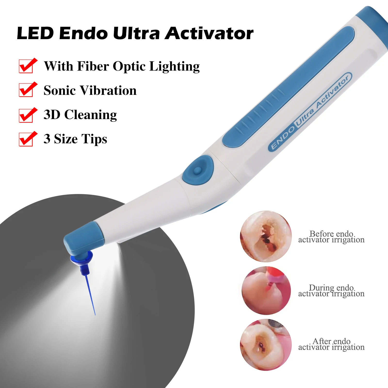 Dental Endodontic Endo Ultra Activator Wireless LED Handpiece Sonic Activator Root Canal Irrigator / Tips