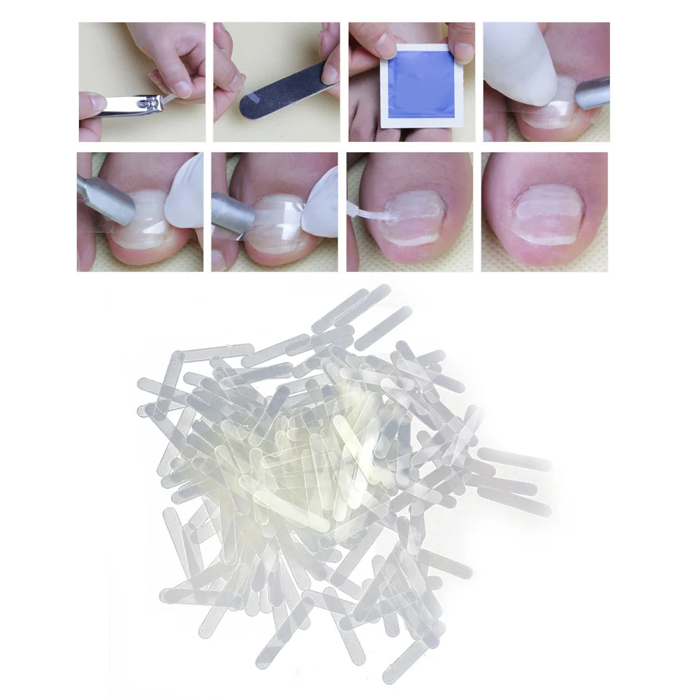 

120 шт., наклейки для коррекции ногтей