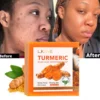 Natural Turmeric Whitening Body Wash, Deeply Clean Skin, Remove Dark Spot, Pimple, Acne, Smooth Skin, For Face & Body Soap Bar 6