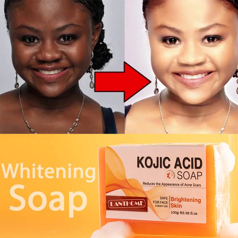 Kojic Acid Soap Before After
