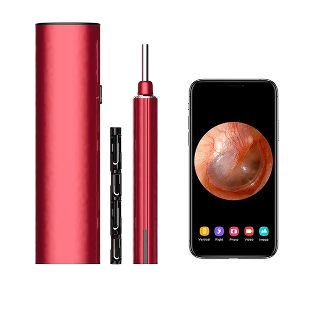 Miredor – cure-oreille avec appareil photo, nettoyeur visuel, oreillette  Visible, Compatible avec iPhone,iPad, téléphones intelligents Android -  AliExpress