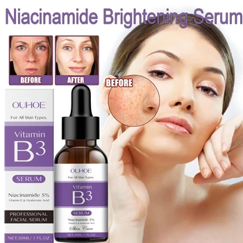 Korea Niacinamide Facial Serum Vitamin B3 Wrinkles Pigment Dark Spot Reduce Correcting Glow Serum Face Whitening Moisturizer