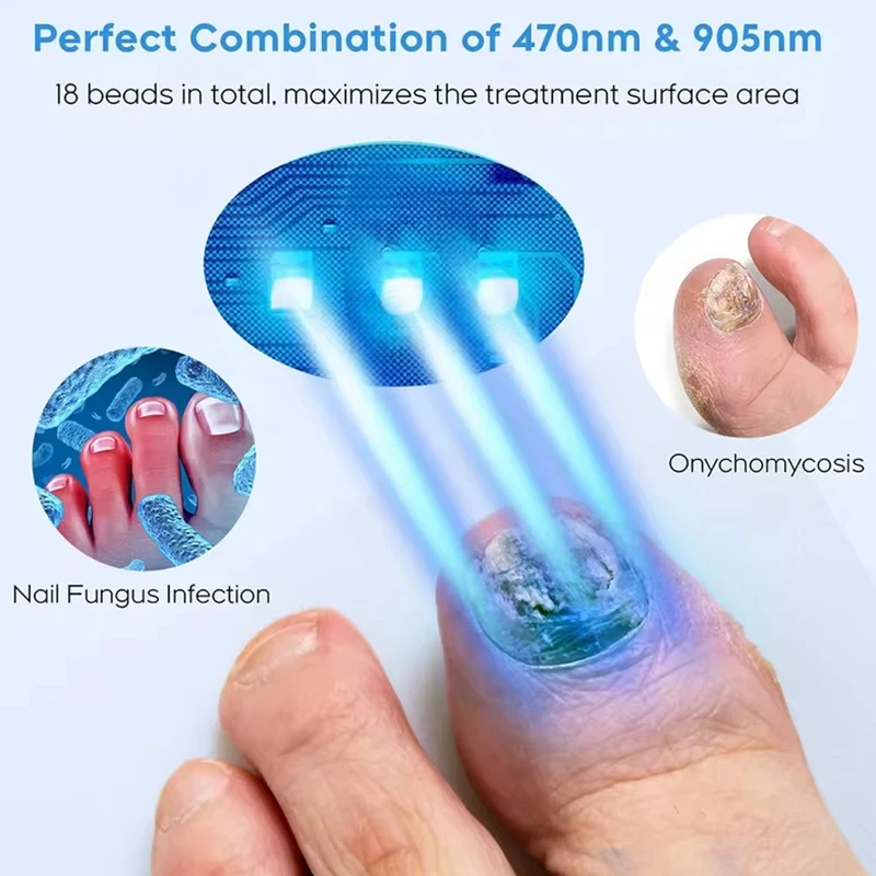 Semi-arc Nail Fungus Laser Device Cure Onychomycosis Toenail Fingernail Fungal Therapy Time display nail fungus remover,laser therapy pen