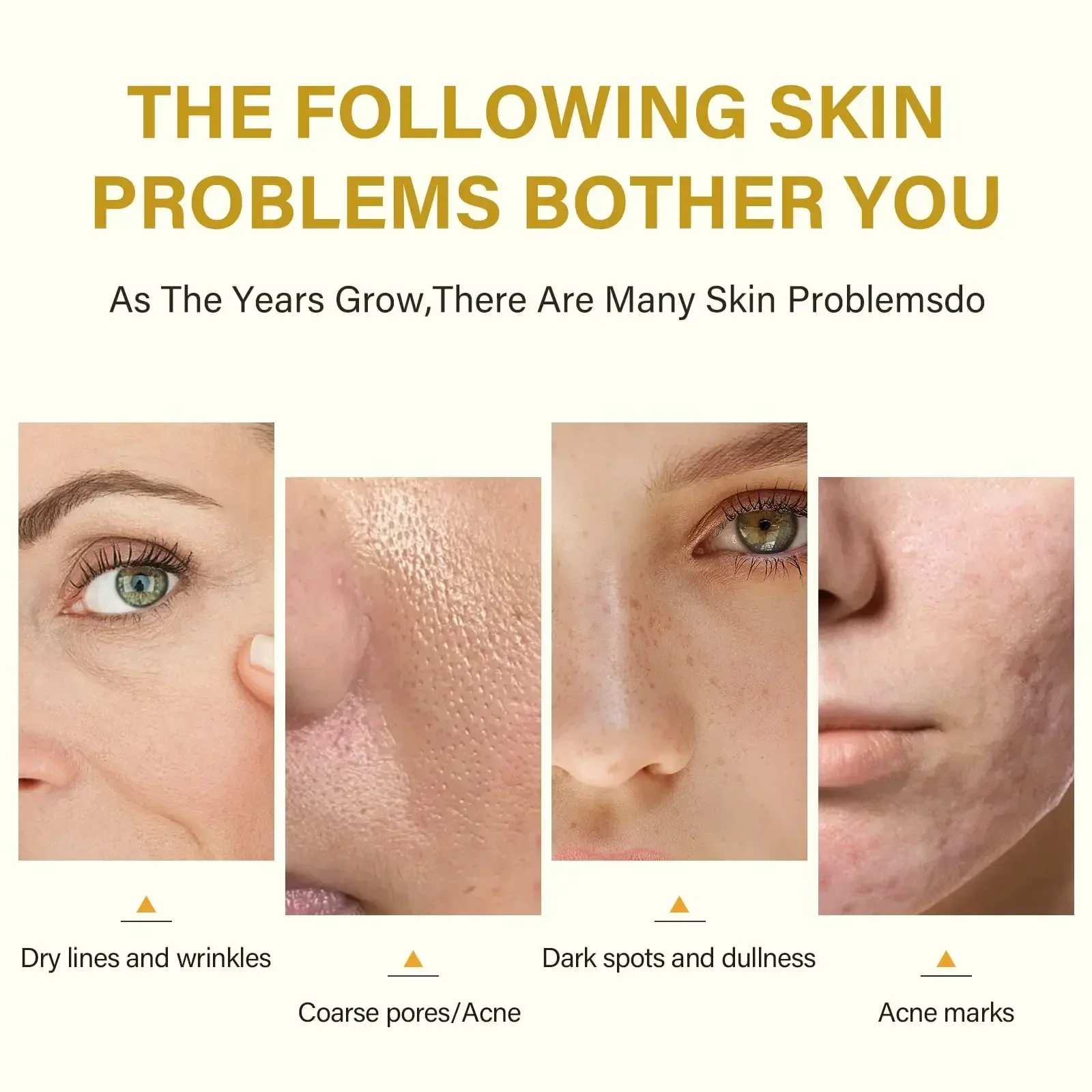 Acid Peeling Serum Chemical Exfoliant Peel for remove Face Dark Skin Spots Whiten Lighten Melanin Peeling Solution Skin P bleaching skin care set
