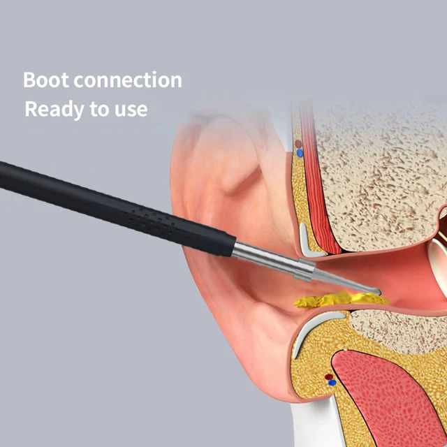 Smart Visual Ear Cleaner 3-in-1 Ear Sticks Otoscope USB C Charging Endoscope Wax Removal Tool Earpick Mini Camera Health Care 6