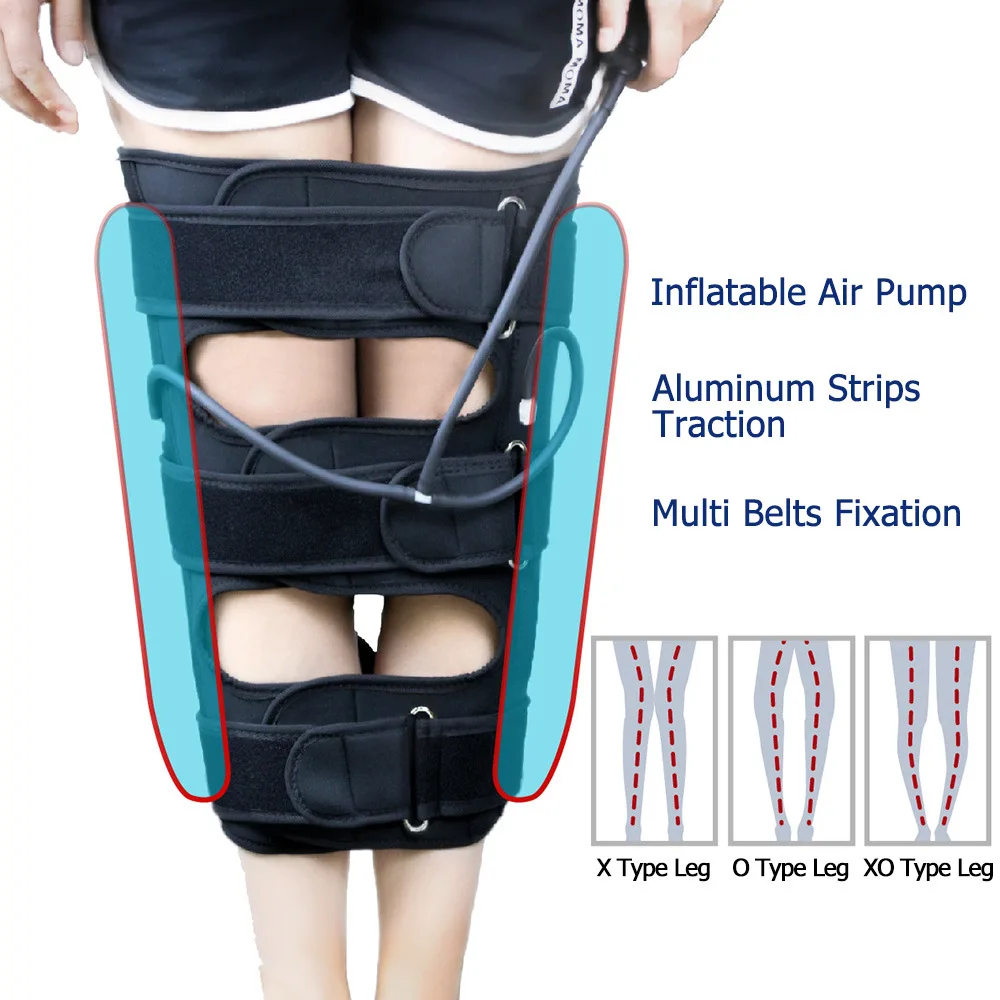 

Inflatable Leg Posture Corrector,X/O Shape Leg Correction Brace Bandage Straighten Professional Knee Valgus Straighten Belt