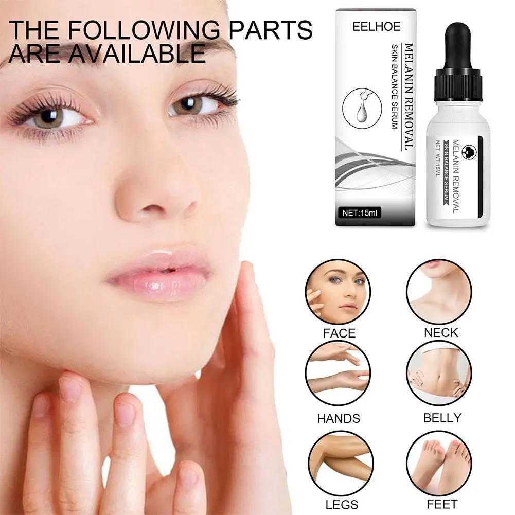 

15 мл темная средство для удаления пятен сыворотка мощное удаление черная точка мелазма хлоазма Niacinamide эффективное отбеливание влаги Уход за кожей лица