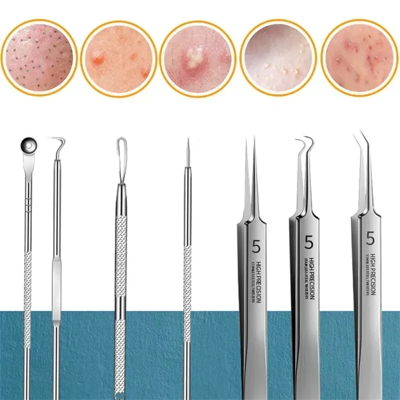 Blackhead & Acne Remover Set 5