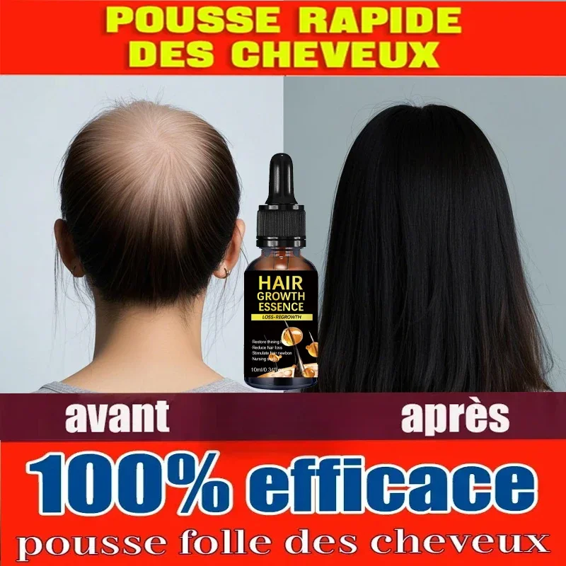Effective Hair Growth Oil Loss Repair Genetic Hair Loss Postpartum Seborrheic