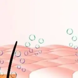 Blackhead Remover Vacuum Pore Cleaner Acne Extractor Tool