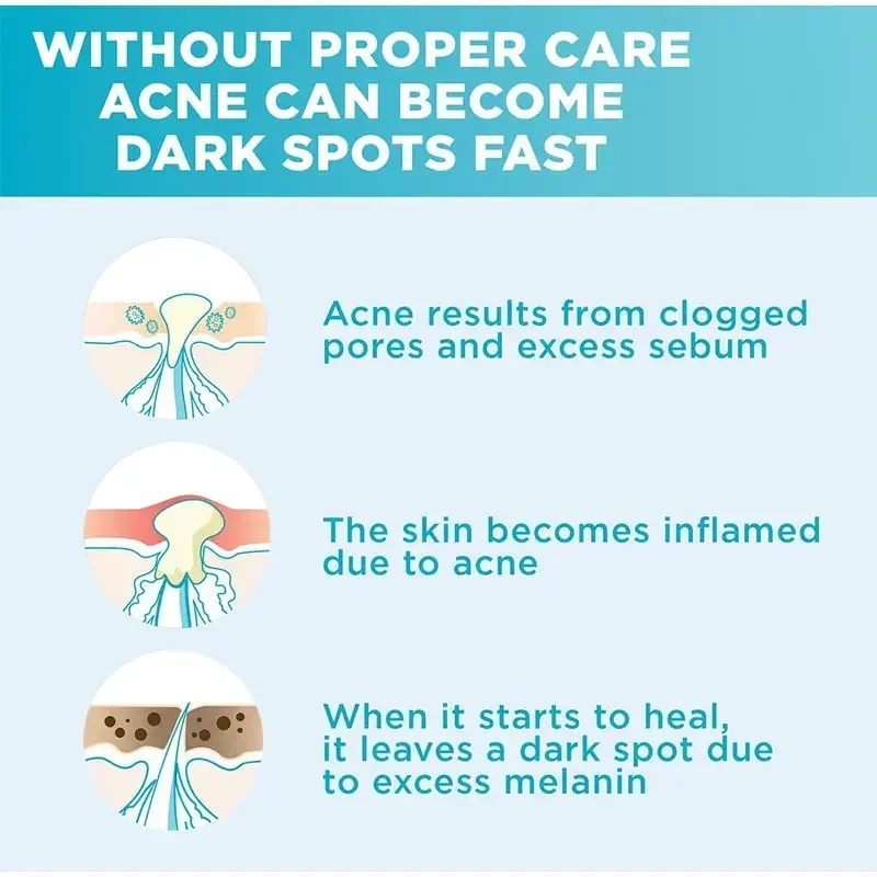 Skin Texture | Pore Refining Resurfacing, Brightening Facial Serum with Retinol and Niacinamide Non-Comedogenic 4