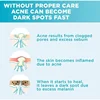 Skin Texture | Pore Refining Resurfacing, Brightening Facial Serum with Retinol and Niacinamide Non-Comedogenic 4