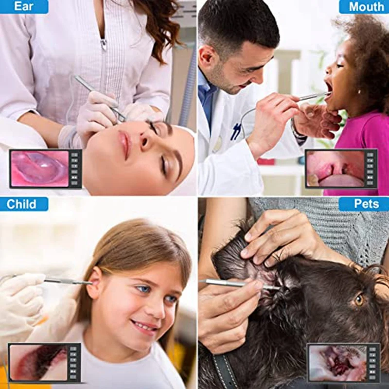 Digital Otoscope Set With 7-Inch Screen Ear Camera Kit Visual Ear Scoop Supports Photo Snapshots And Video Recording 3