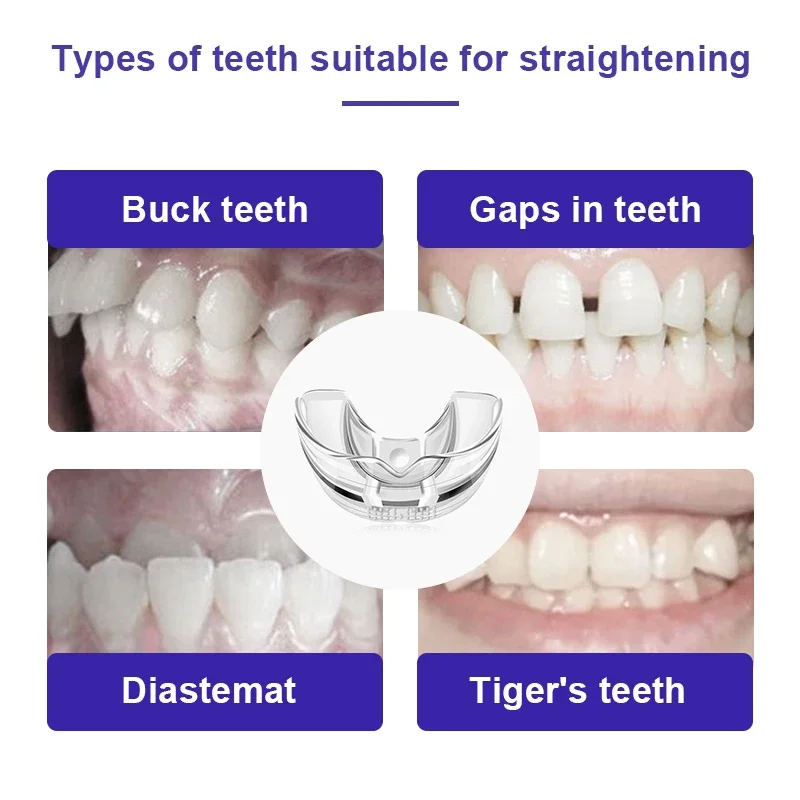 1/3 Stuks Tanden Corrector Tand Orthodontische Trainer Nep Beugels Trainer Voor Tanden Uitlijning 3 Fasen Voor Volwassenen Tandverzorging Gereedschap