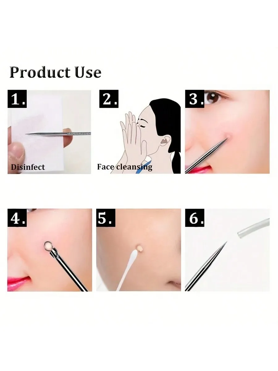 Stainless Steel Acne Removal Tool Set for Blackheads and Pimples
