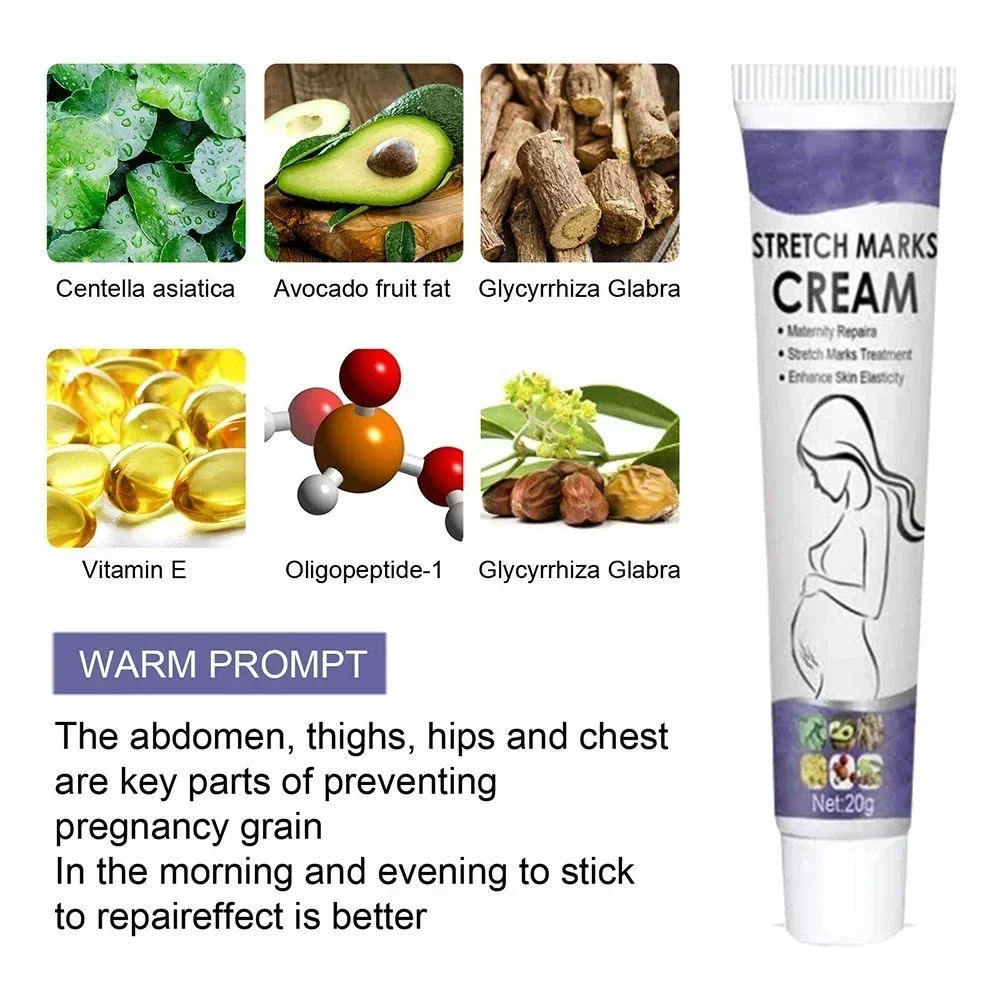 Eliminate Red White Old Stretch Marks Cream For Pregnancy Postpartum Skin Care Gel 6
